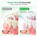 FRESKO Water Dental Flosser for Teeth, 300ML Cordless Flosser with Constant Pressure, Rechargeable Oral Irrigator Cleaner for Travel Home Use and Braces Care, IPX7 Waterproof, 5 Jet Tips