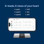AliveCor KardiaMobile 6-Lead Personal EKG Monitor – Six Views of The Heart – Detects AFib and Irregular Arrhythmias – Instant Results in 30 Seconds – Works with Most Smartphones