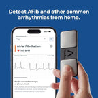 KardiaMobile 1-Lead Personal EKG Monitor