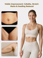 Lymphatic Drainage Massager & Anti Cellulite Massage Tool, Helps Reduce Stretch Marks & Cellulite, for Legs, Arms & Belly, Body Sculpting Machine with Microcurrent, Light, Heat & Vibration