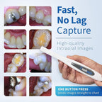 MouthWatch Intraoral Camera, Crystal Clear Images with an Easy to Use, Fast, Single Button Operation Dental Camera, Compatible with Over 50 Dental Imaging Suites, Lightweight and Ergonomic, 31 Grams
