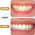 Lumineux Teeth Whitening Strips - 35 Treatments (6 Months) – Peroxide Free - Enamel Safe for Whiter Teeth - Whitening Without The Sensitivity - Dentist Formulated - Sensitivity Free