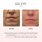Glov Beauty - Anti-Aging LED Face Mask Red Light Therapy for Wrinkles, Fine Lines & Firmer Skin - Four Color Modes - Easy 10 Minute Session, Rechargeable, Facial Home Spa Device