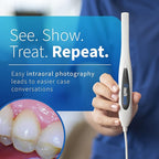 MouthWatch Intraoral Camera, Crystal Clear Images with an Easy to Use, Fast, Single Button Operation Dental Camera, Compatible with Over 50 Dental Imaging Suites, Lightweight and Ergonomic, 31 Grams