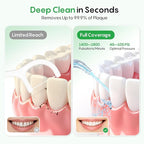 FRESKO Water Dental Flosser for Teeth, 300ML Flosser with Constant Pressure, Rechargeable Oral Irrigator Cleaner for Travel with 5 Jet Tips, IPX7 Waterproof