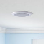 TOPELER 6Inch LED Disk Light, 15W Dimmable Surface Flush Mount Ceiling Light, 1000Lm 5000K Daylight, Installs into Junction Box Or Recessed Can, ETL & FCC Listed, White