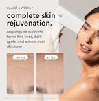 Nood™ NEW Flasher Pro — IPL Laser Hair Removal Device & Anti-Aging Red Light Therapy for Women & Men — Pain-free, Permanent, Visible Results After First Use & Works Everywhere Hair Grows — Gloss White